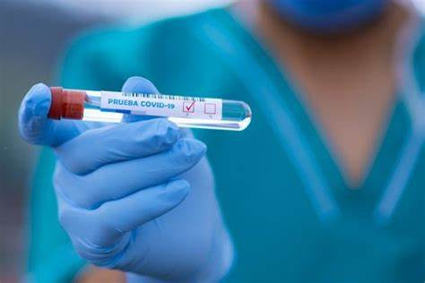  Salud Pública reporta 271 nuevos casos de COVID-19 y 2,647 activos