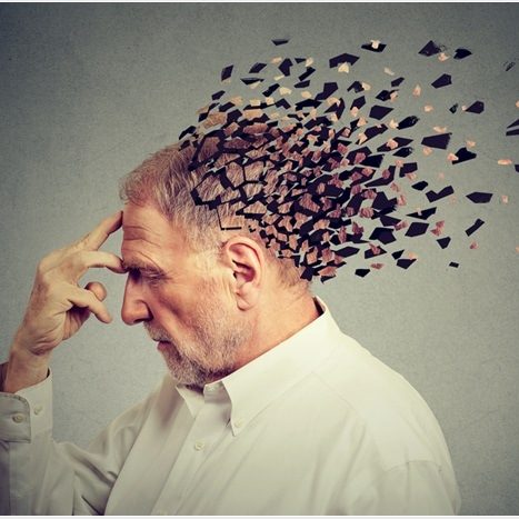  Enfermedad de Alzheimer, ¿Cada vez casos más jóvenes?