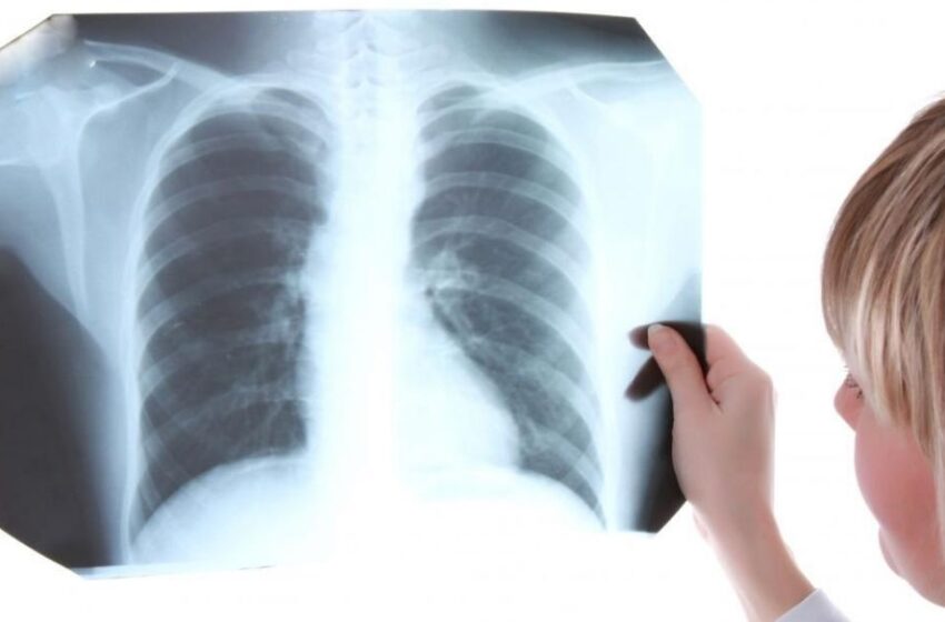  Dan inicio a taller internacional sobre manejo clínico de Tuberculosis