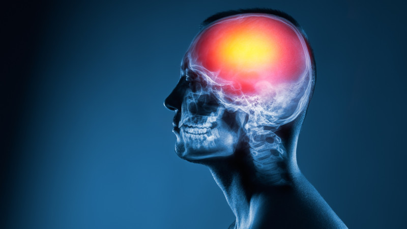  ¿Por qué aumentan los accidentes cerebrovasculares entre los jóvenes?