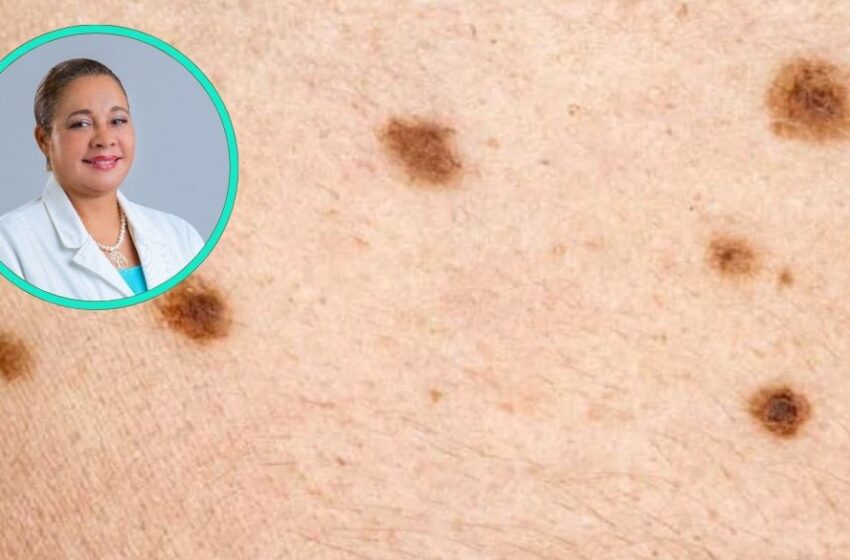  Cáncer de piel: detección temprana y tratamiento
