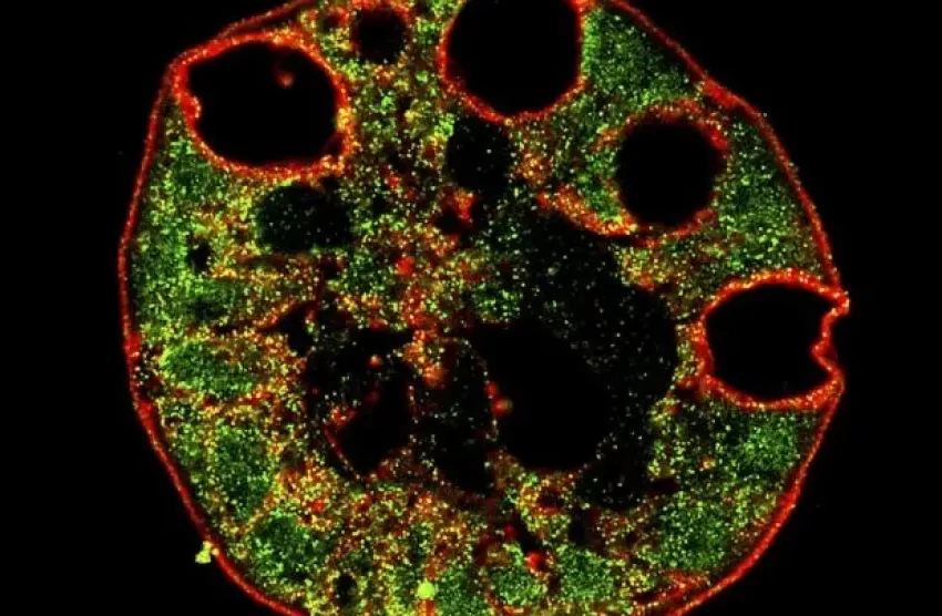  Desarrollan una IA capaz de diferenciar las células cancerosas de las normales