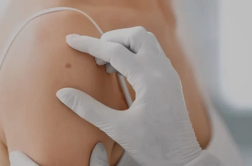  Medicina estética una aliada contra el cáncer