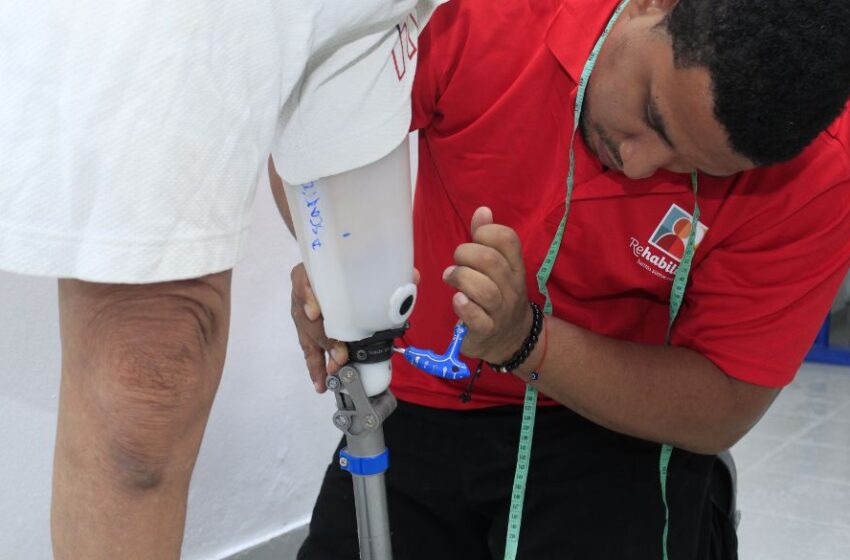  Donación de prótesis beneficia a 75 personas amputadas