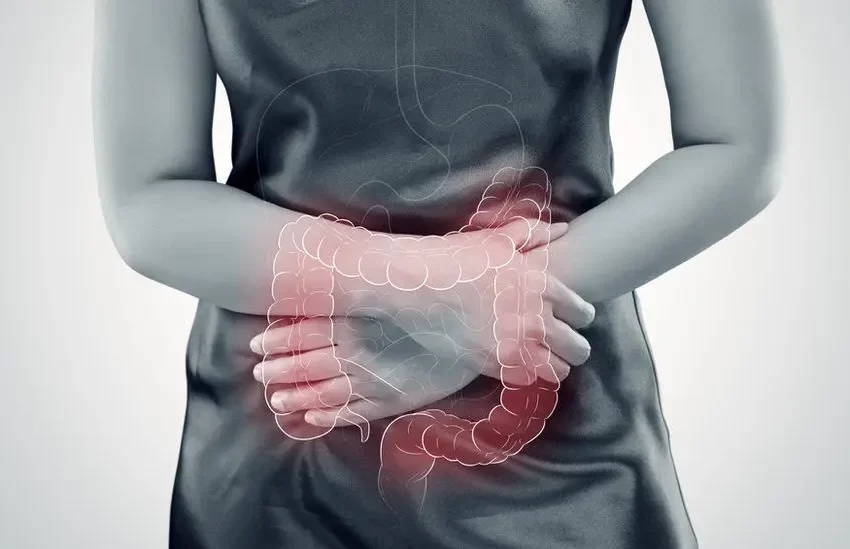  El aumento del cáncer colorrectal en jóvenes podría deberse a una infección en la infancia