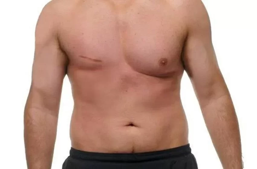  Cáncer de mama también afecta a los hombres: más de 500 casos registrados en 2024