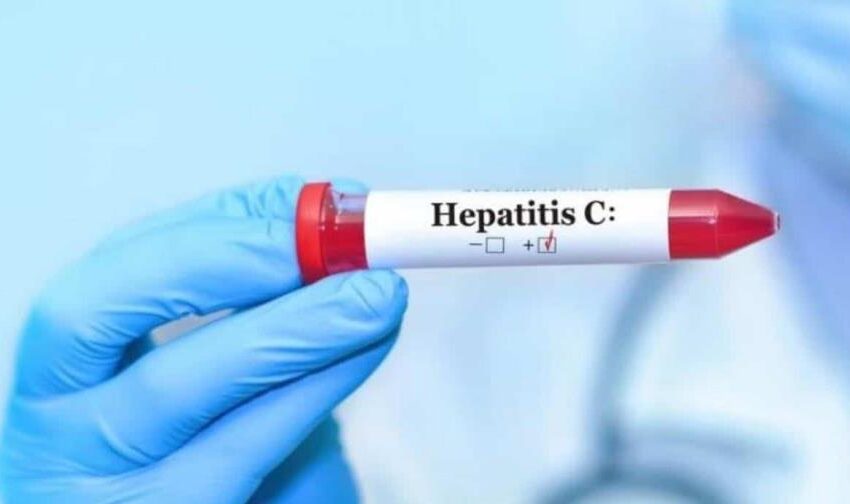  Salud Pública reporta 812 casos de hepatitis C, con mayor incidencia en mujeres