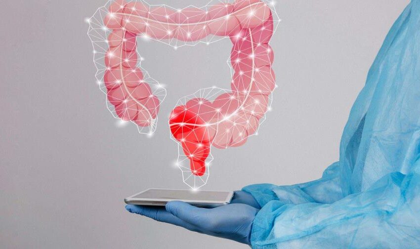  El cáncer colorrectal se protege de la inmunoterapia con un doble escudo, según un estudio