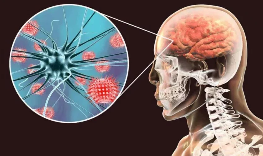  Ojo con la meningitis