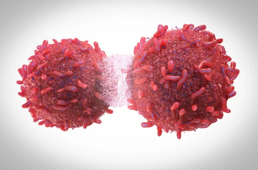  Aumenta en NYC cáncer de colon menores de 50 años