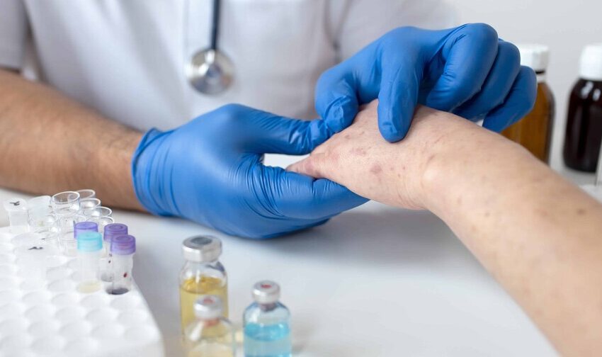  OPS advierte del aumento de casos de sarampión en las Américas