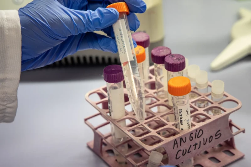  Científicos desarrollan terapia génica para prevenir el alzhéimer