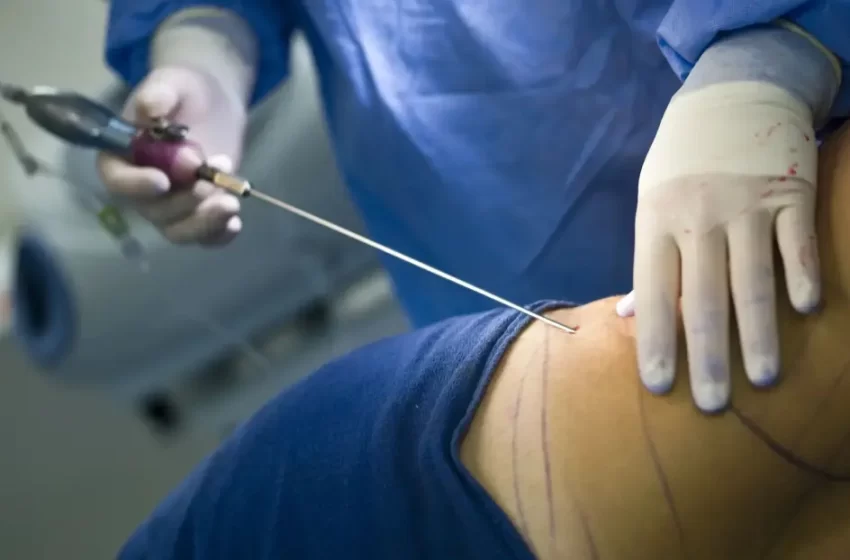  ¿Cómo verificar si un cirujano plástico está certificado en RD?
