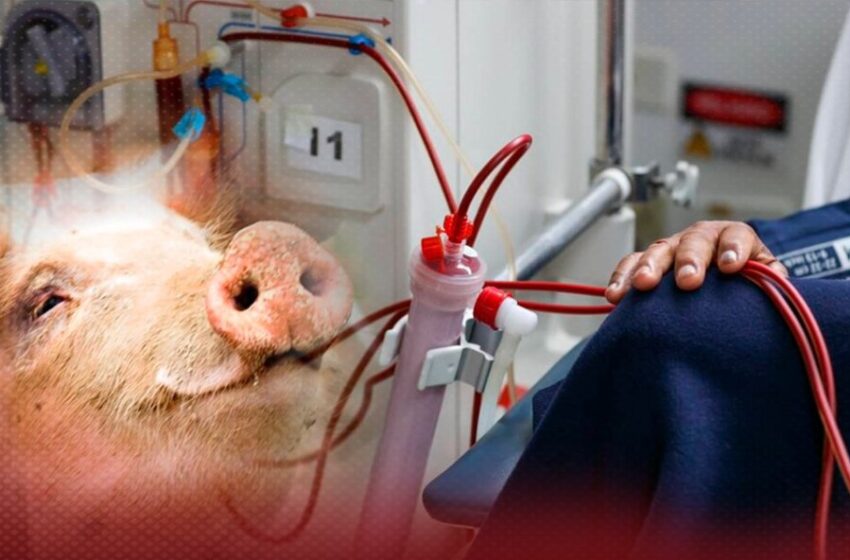  Hombre pasa nueve meses sin diálisis gracias a un riñón de cerdo hasta que pudo hacer trasplante