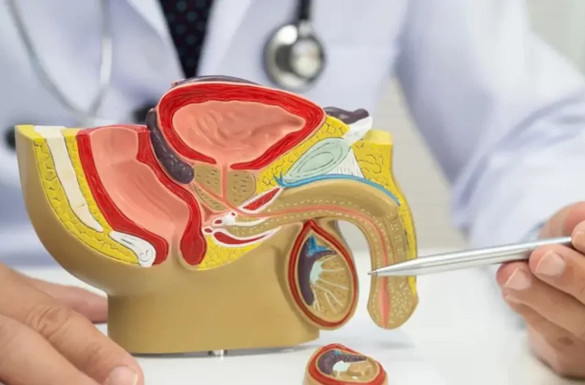  Cáncer de mama y cáncer de próstata: comprender sus conexiones