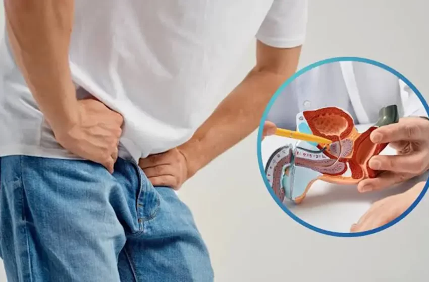  ¿Pueden los botánicos dietéticos ayudar a controlarlos síntomas de la HBP? Una perspectiva profesional