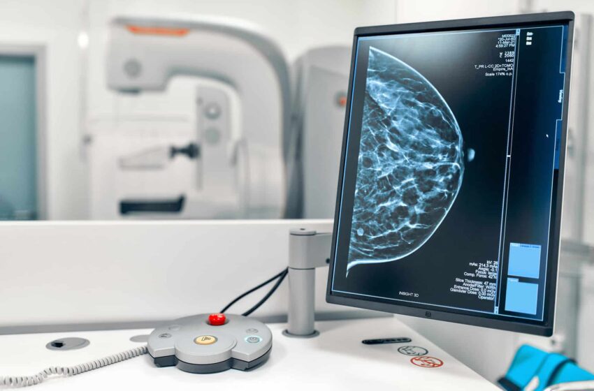  Oncólogos llaman a fortalecer la detección temprana del cáncer de mama en República Dominicana